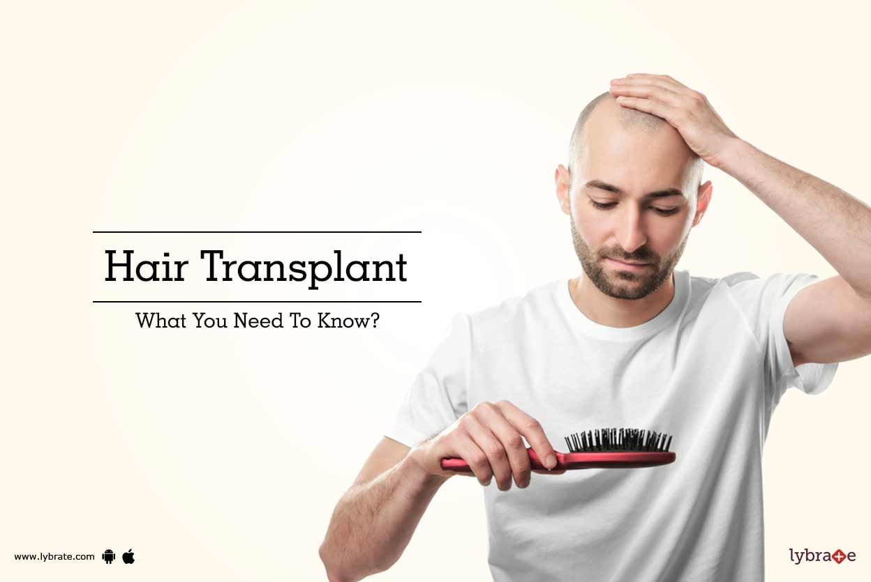 Hair Transplant: What You Need To Know?