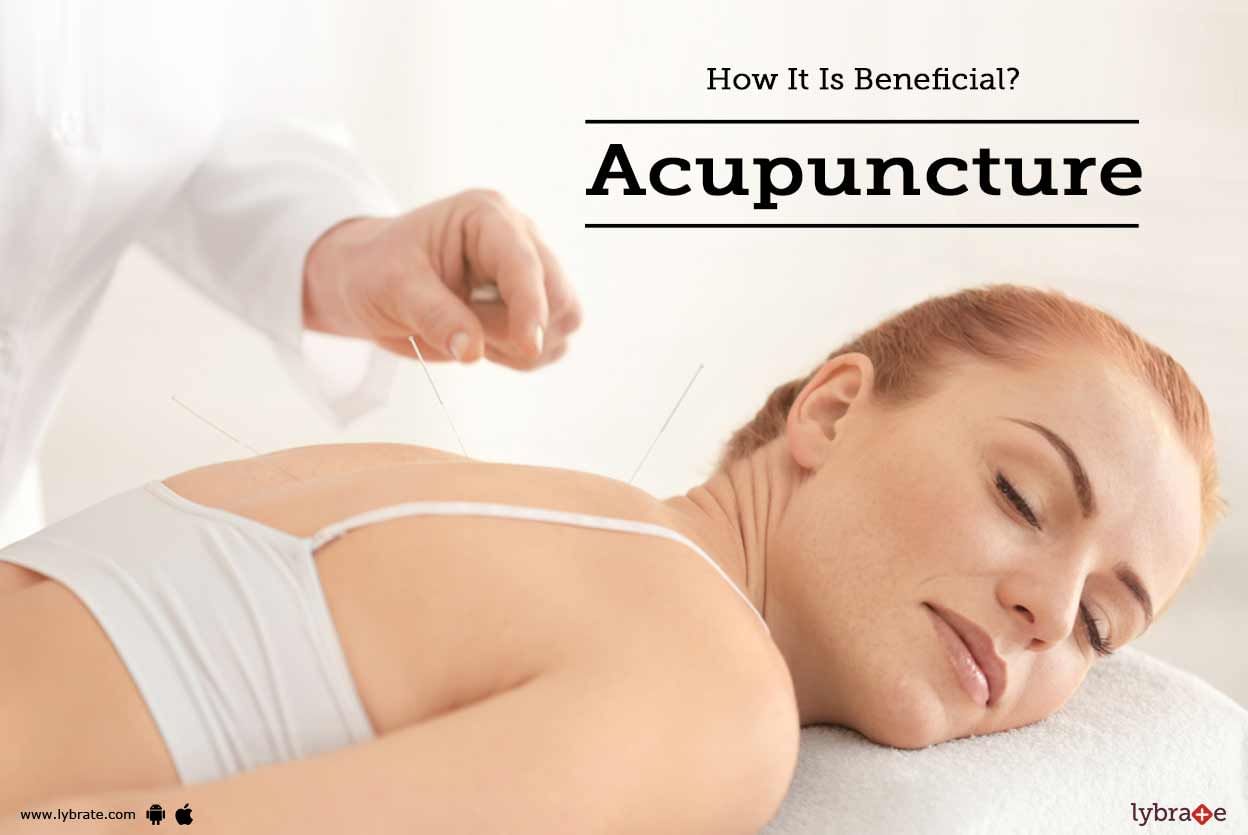 Acupuncture - How It Is Beneficial?