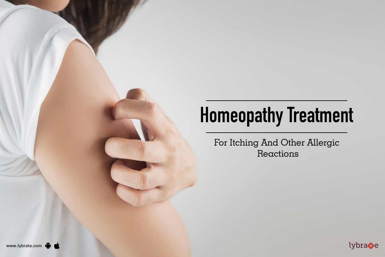 Homeopathy Treatment For Itching & Allergic Reactions