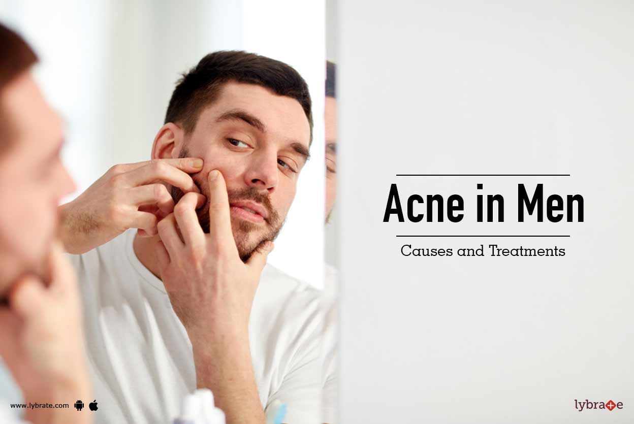 Acne In Men Causes And Treatments By Isaac International Skin And Anti Ageing Centre Lybrate