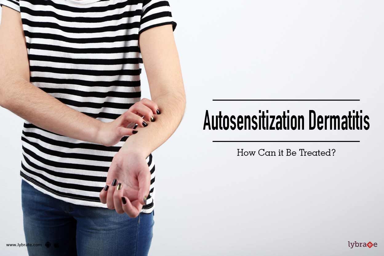 Autosensitization Dermatitis - How Can it Be Treated?