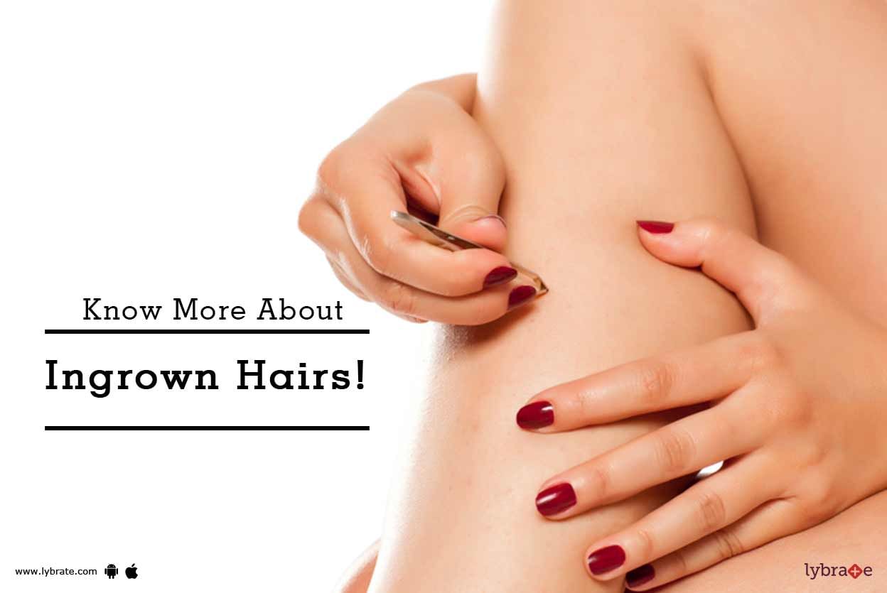 Know More About Ingrown Hairs!