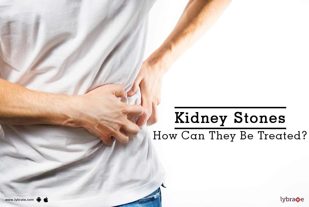 Kidney Stones - How Can They Be Treated?