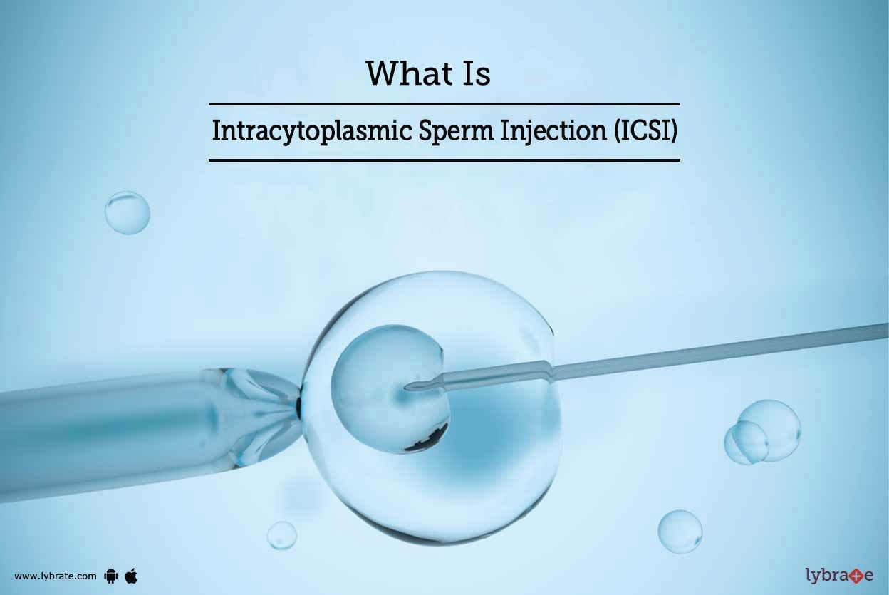 What Is Intra-Cytoplasmic Sperm Injection (ICSI)?