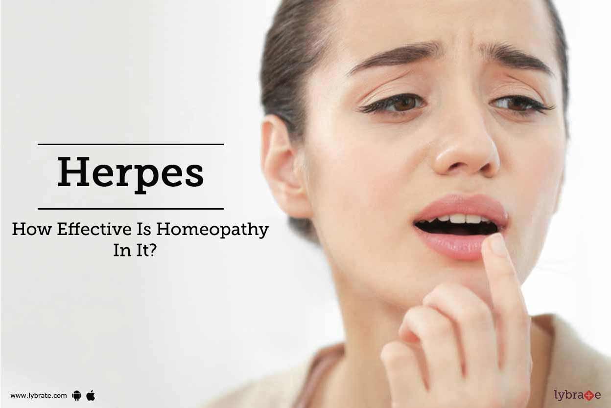 Herpes - How Effective Is Homeopathy In It?