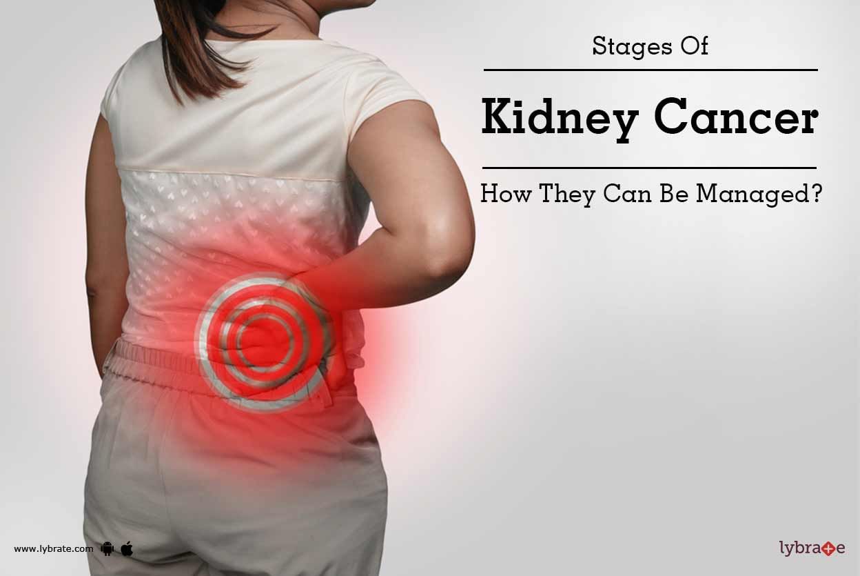 Stages Of Kidney Cancer - How They Can Be Managed?