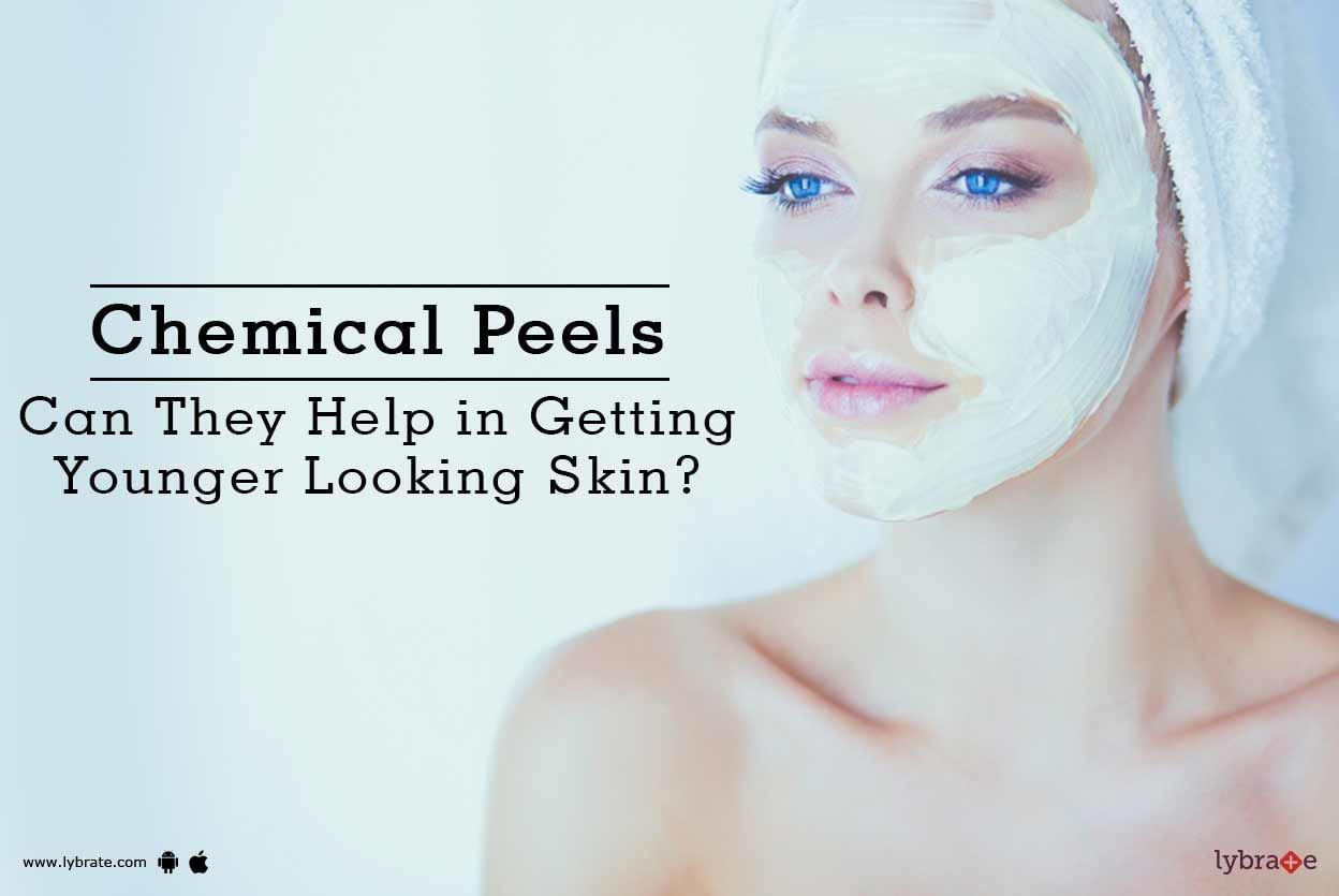 Chemical Peels - Can They Help in Getting Younger Looking Skin?