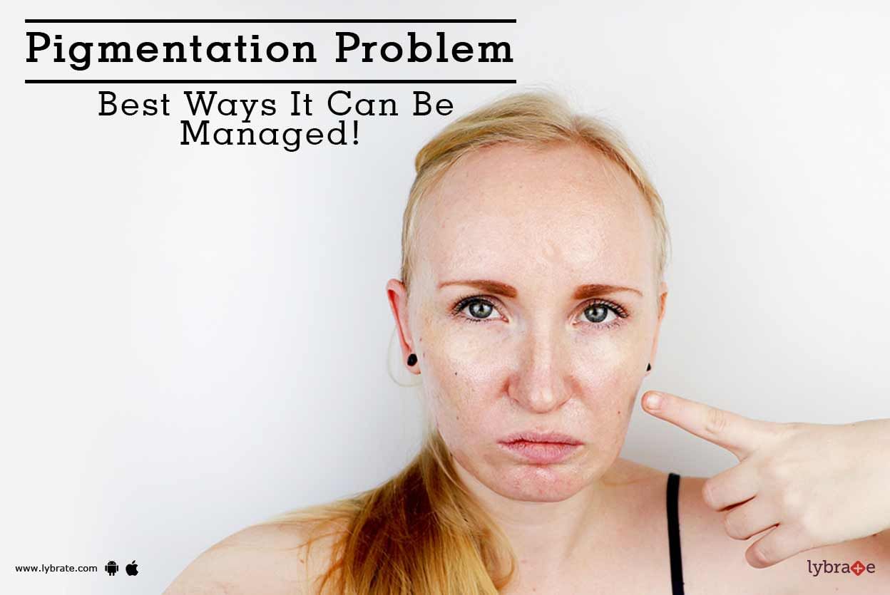 Pigmentation Problem - Best Ways It Can Be Managed!