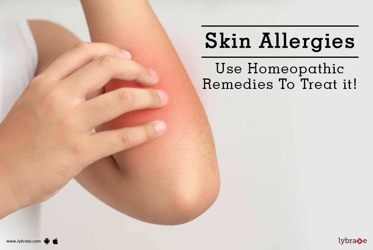 Skin Allergies - Use Homeopathic Remedies To Treat it!