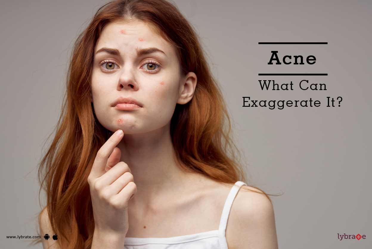 Acne - What Can Exaggerate It?