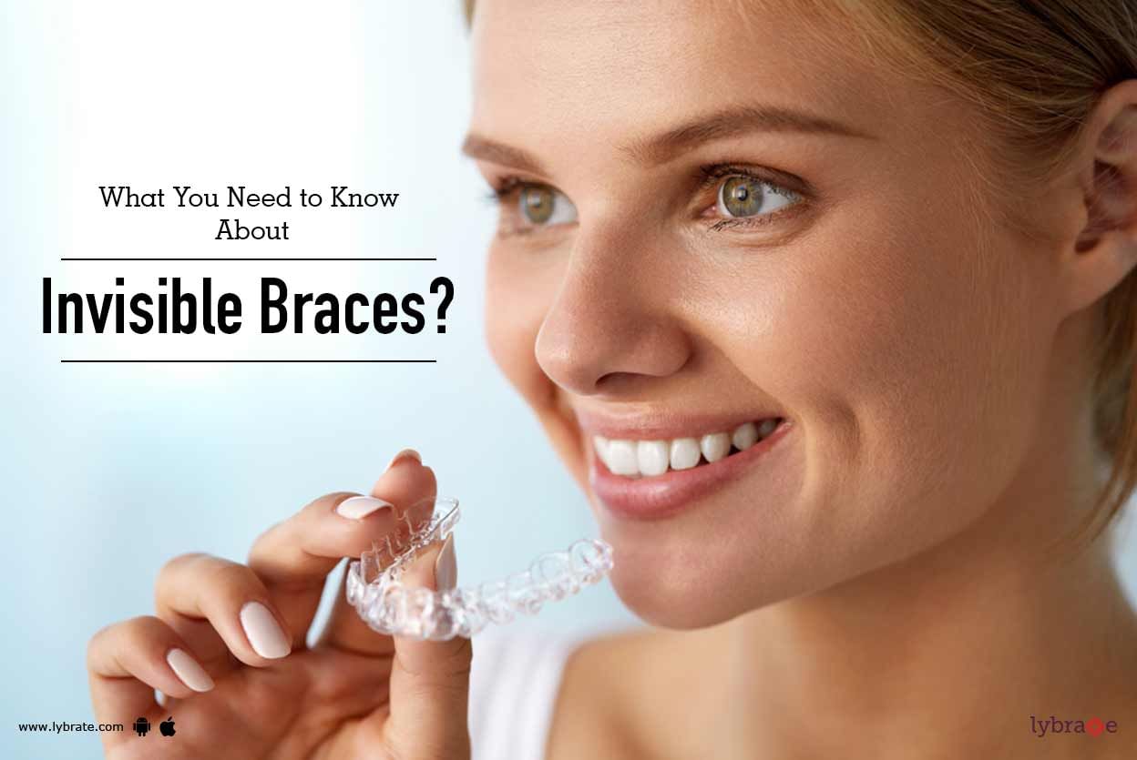 What You Need to Know About Invisible Braces?