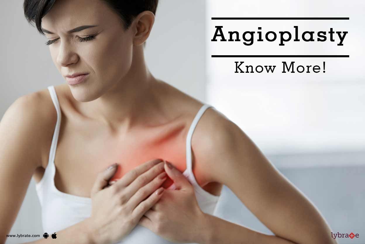 Angioplasty - Know More!