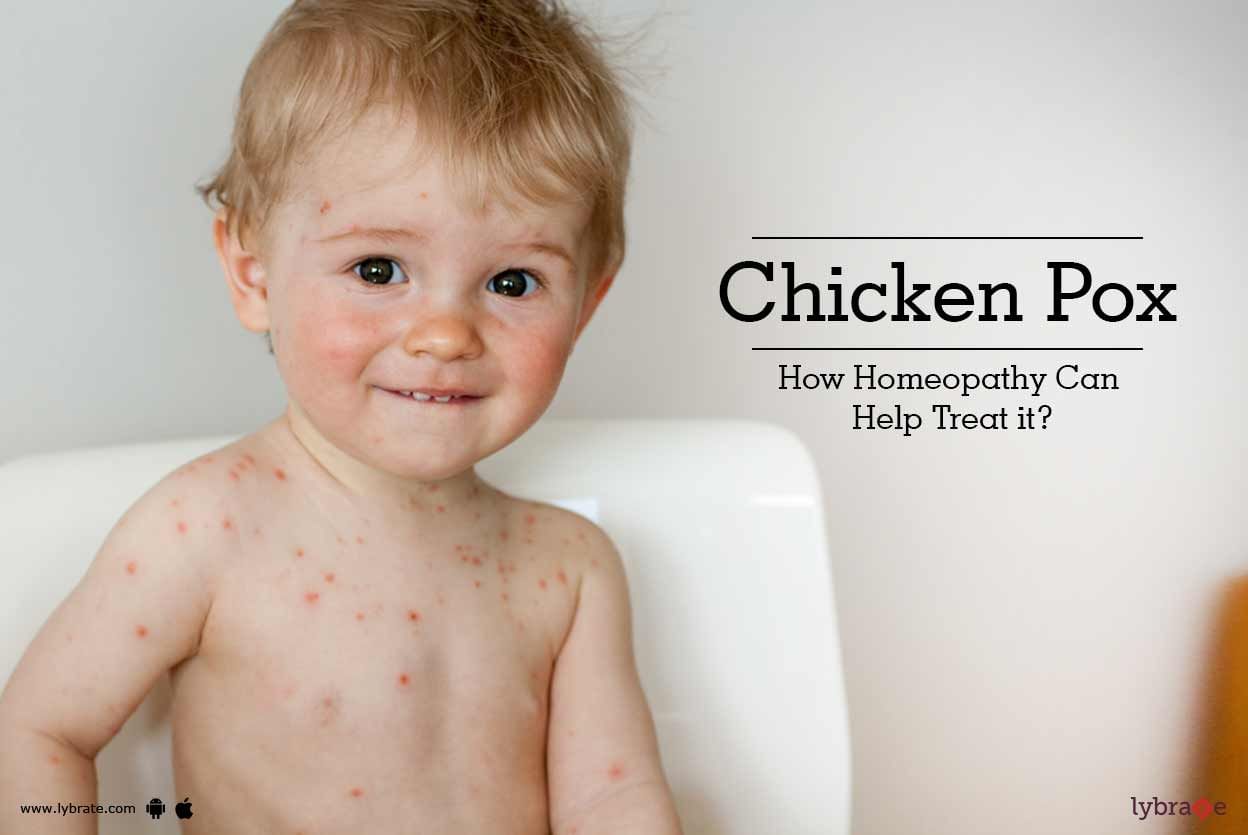 Chicken Pox - How Homeopathy Can Help Treat it?
