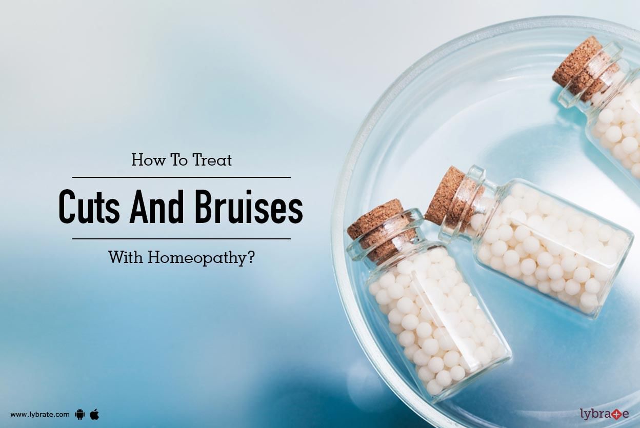 How To Treat Cuts And Bruises With Homeopathy?