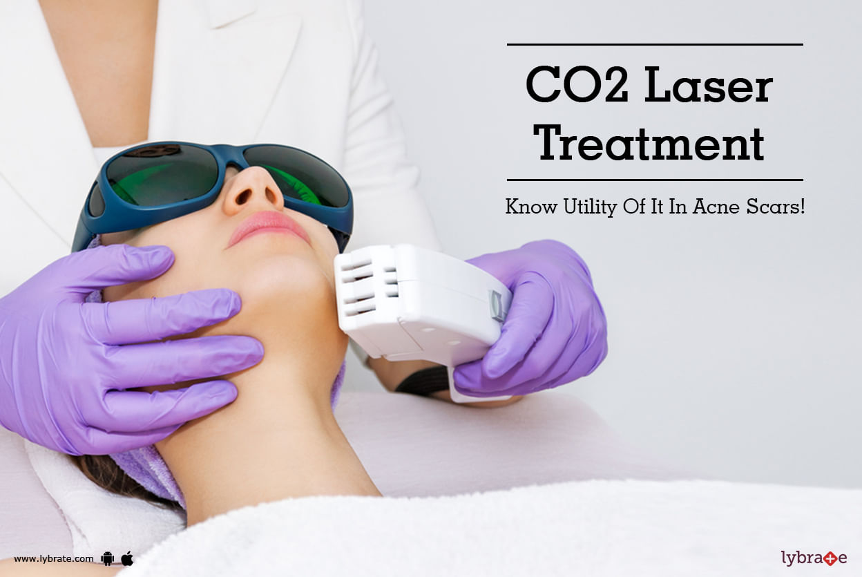 CO2 Laser Treatment - Know Utility Of It In Acne Scars!