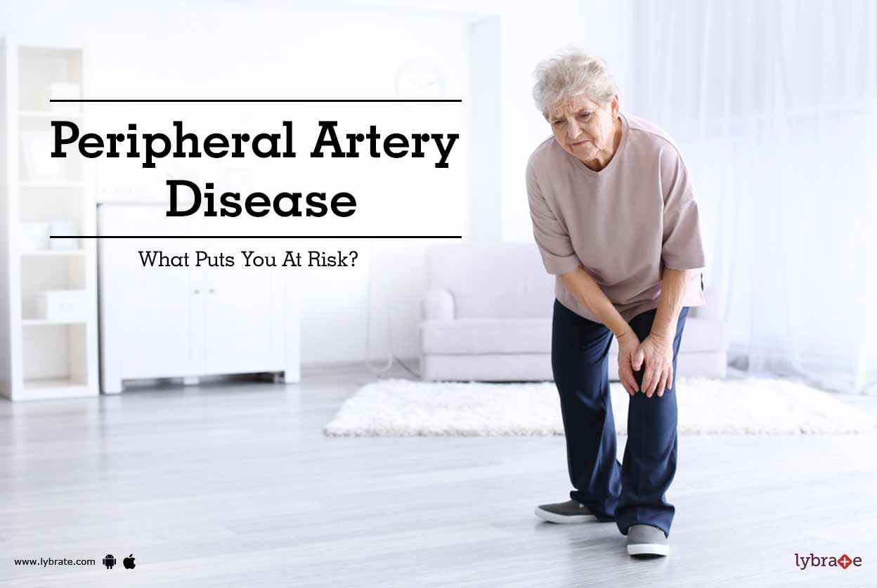 Peripheral Artery Disease - What Puts You At Risk?