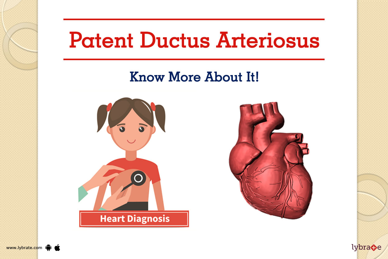 Patent Ductus Arteriosus - Know More About It!