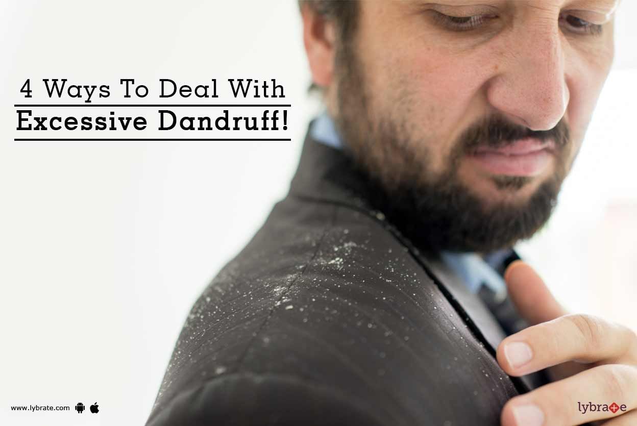 4 Ways To Deal With Excessive Dandruff!