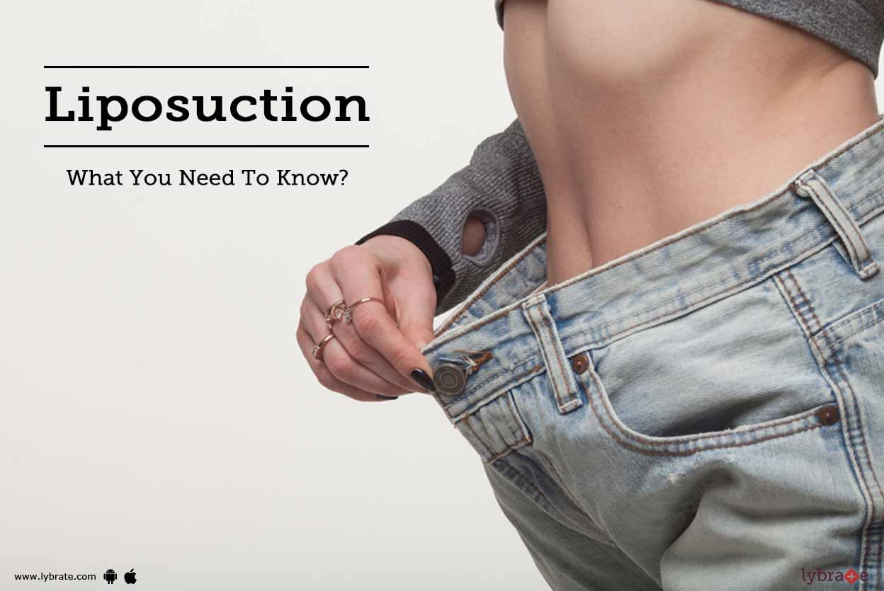 Liposuction: What You Need To Know?
