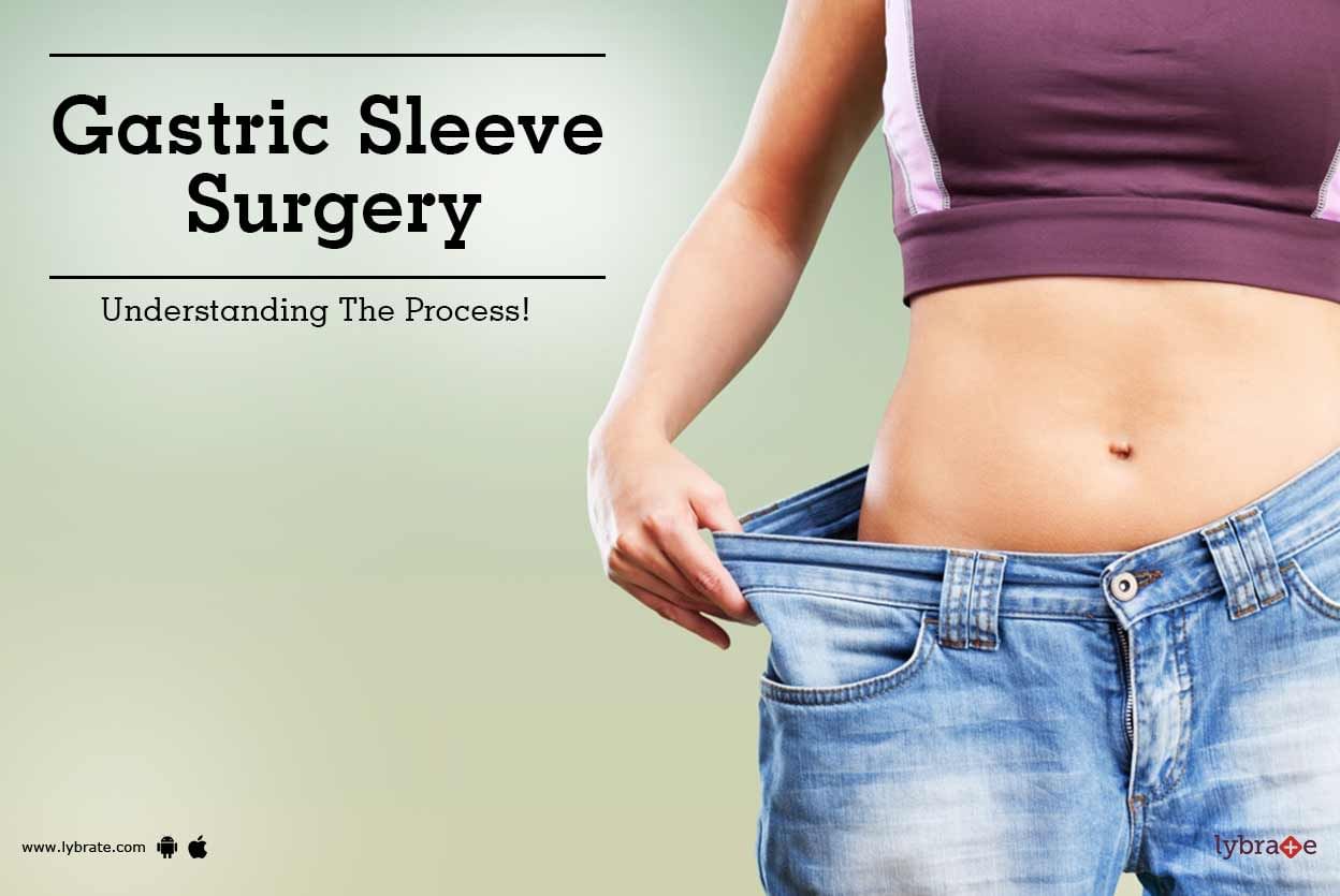 Gastric Sleeve Surgery - Understanding The Process!