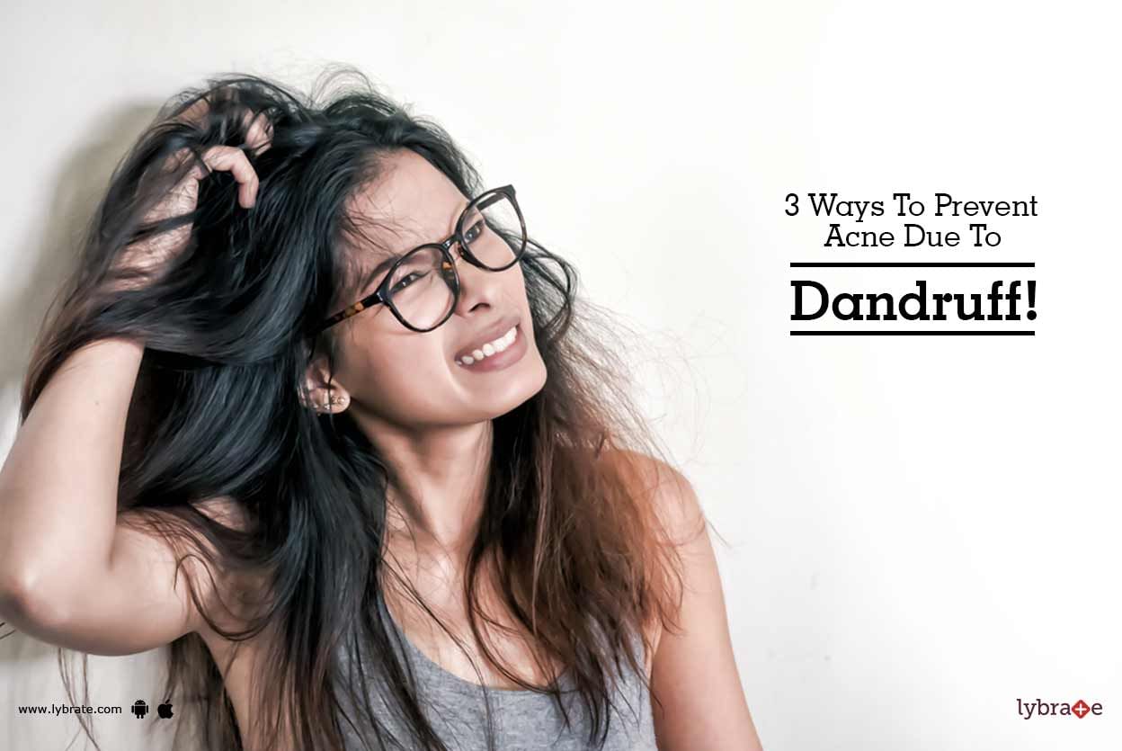 3 Ways To Prevent Acne Due To Dandruff!