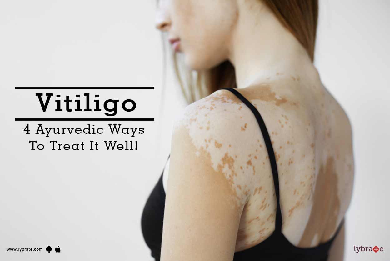 Vitiligo - 4 Ayurvedic Ways To Treat It Well!