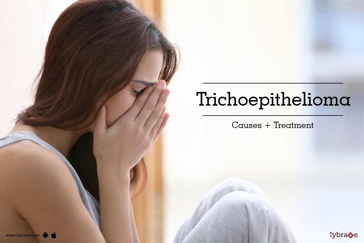 Trichoepithelioma - Causes + Treatment