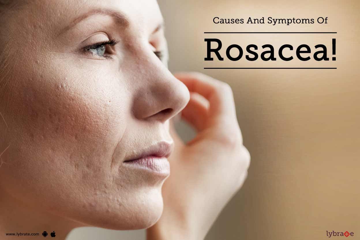Causes And Symptoms Of Rosacea!