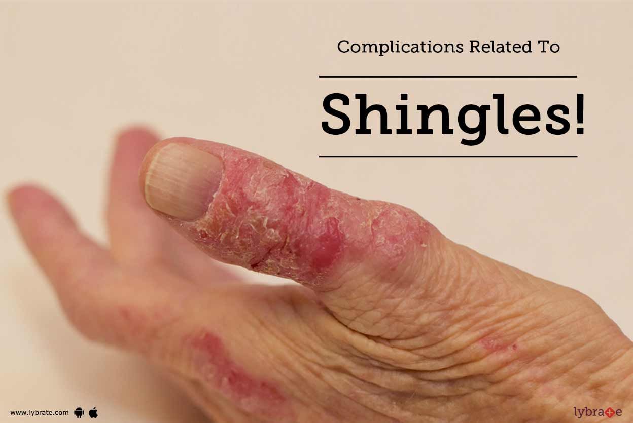 Complications Related To Shingles!