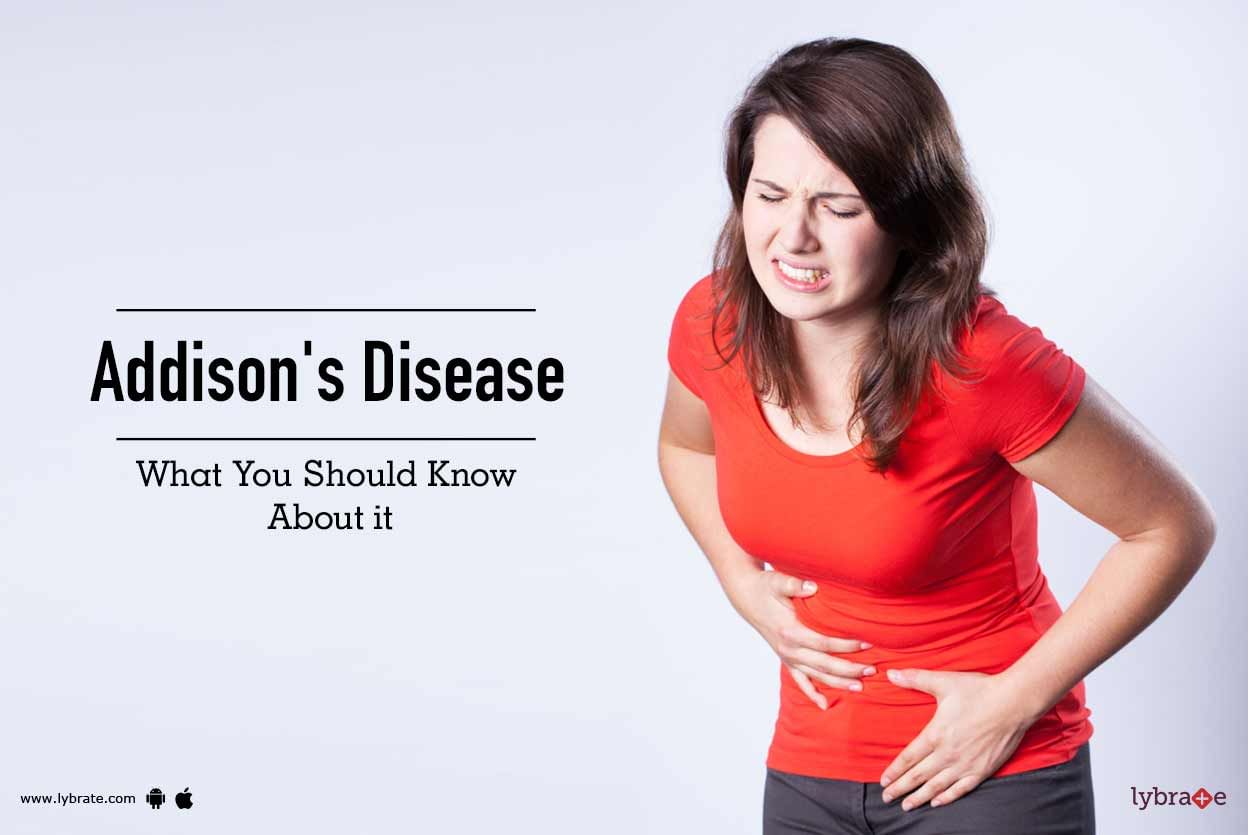 Addison's Disease - What You Should Know About it