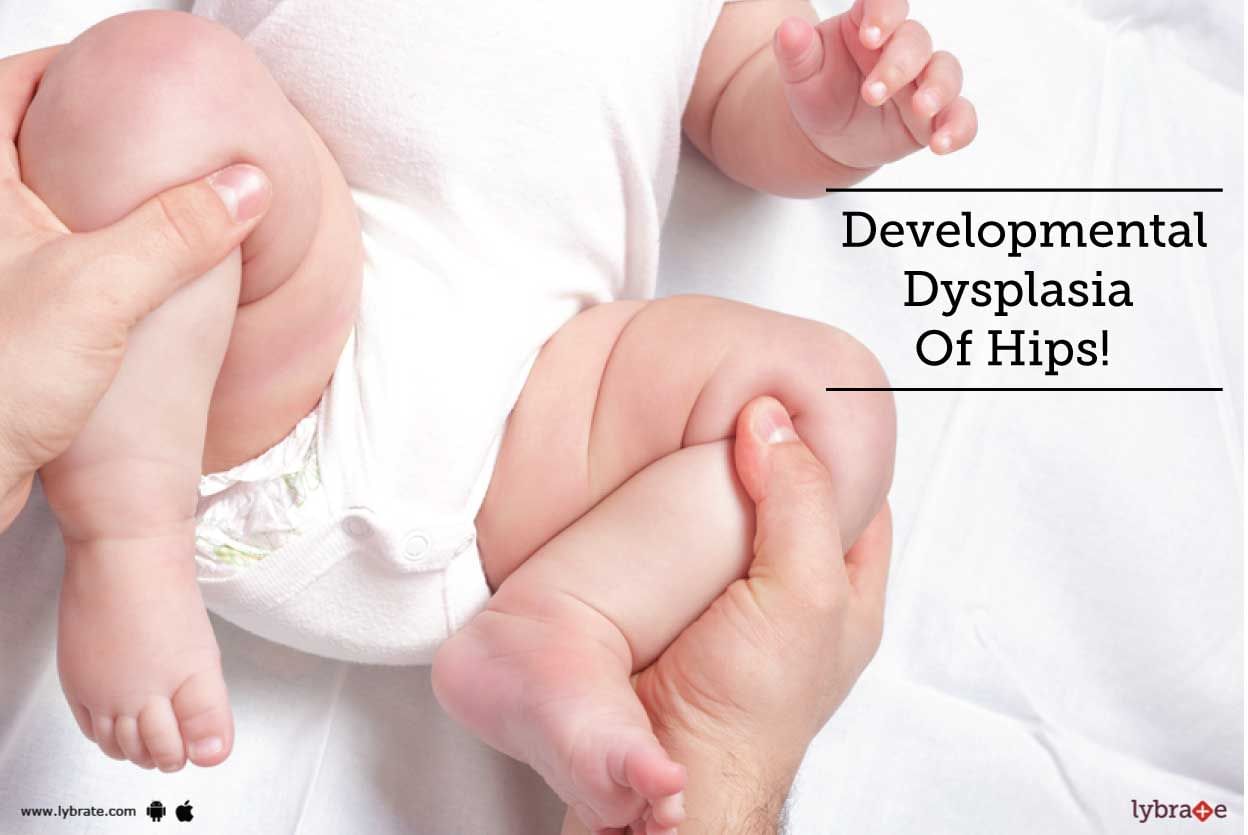 Developmental Dysplasia Of Hips!