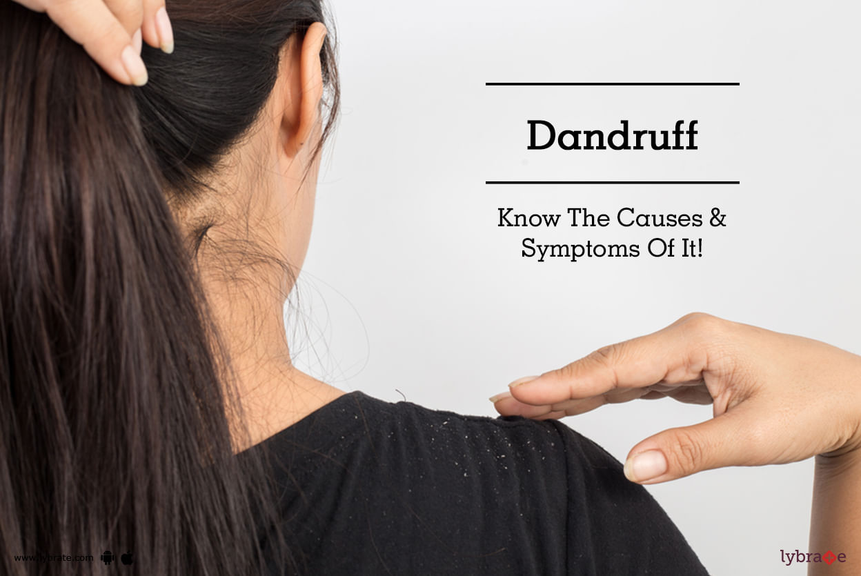 Dandruff - Know The Causes & Symptoms Of It!
