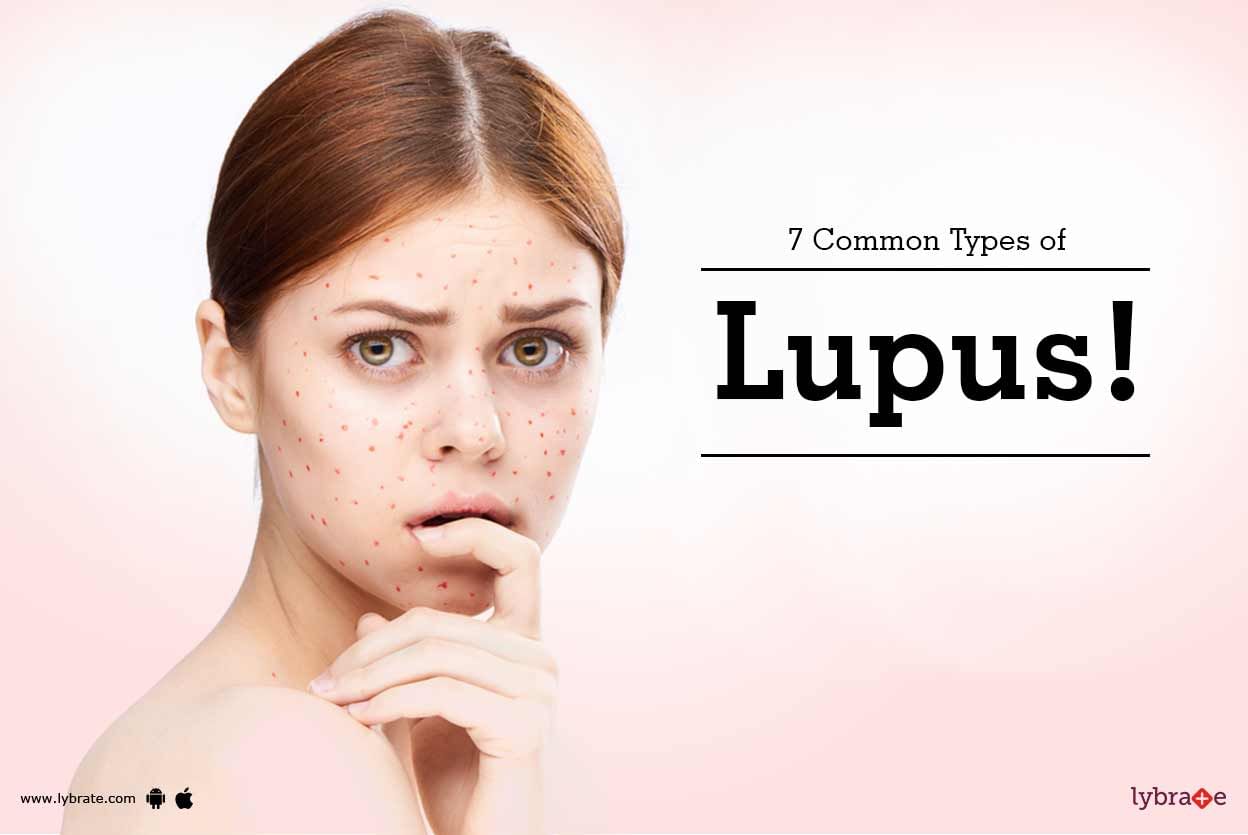 7 Common Types of Lupus!