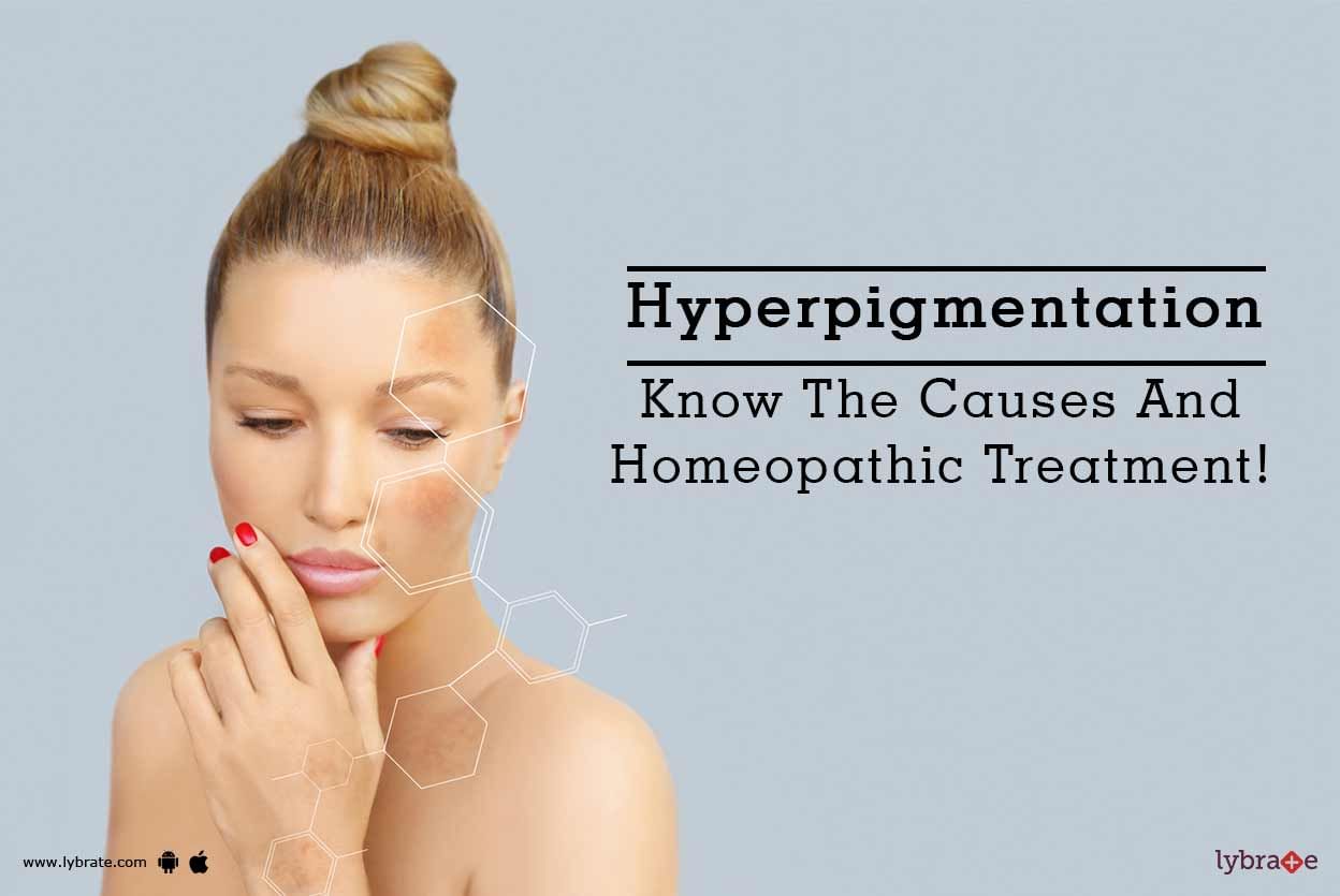 Hyperpigmentation - Know The Causes And Homeopathic Treatment!
