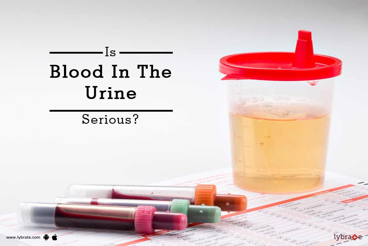 Is Blood In The Urine Serious?