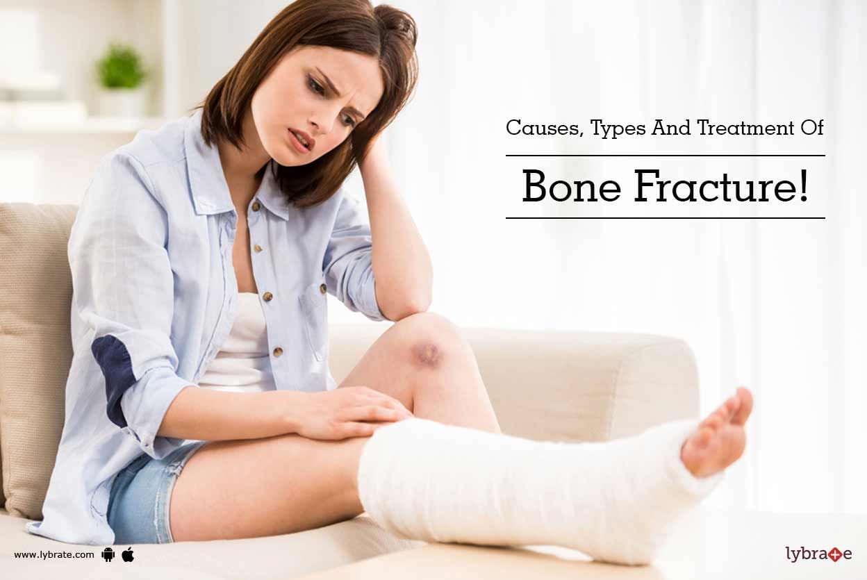 Causes, Types And Treatment Of Bone Fracture!