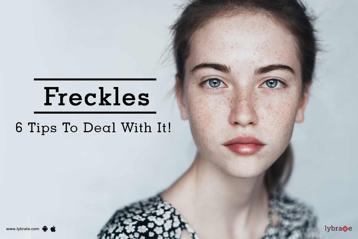 Freckles - 6 Tips To Deal With It!