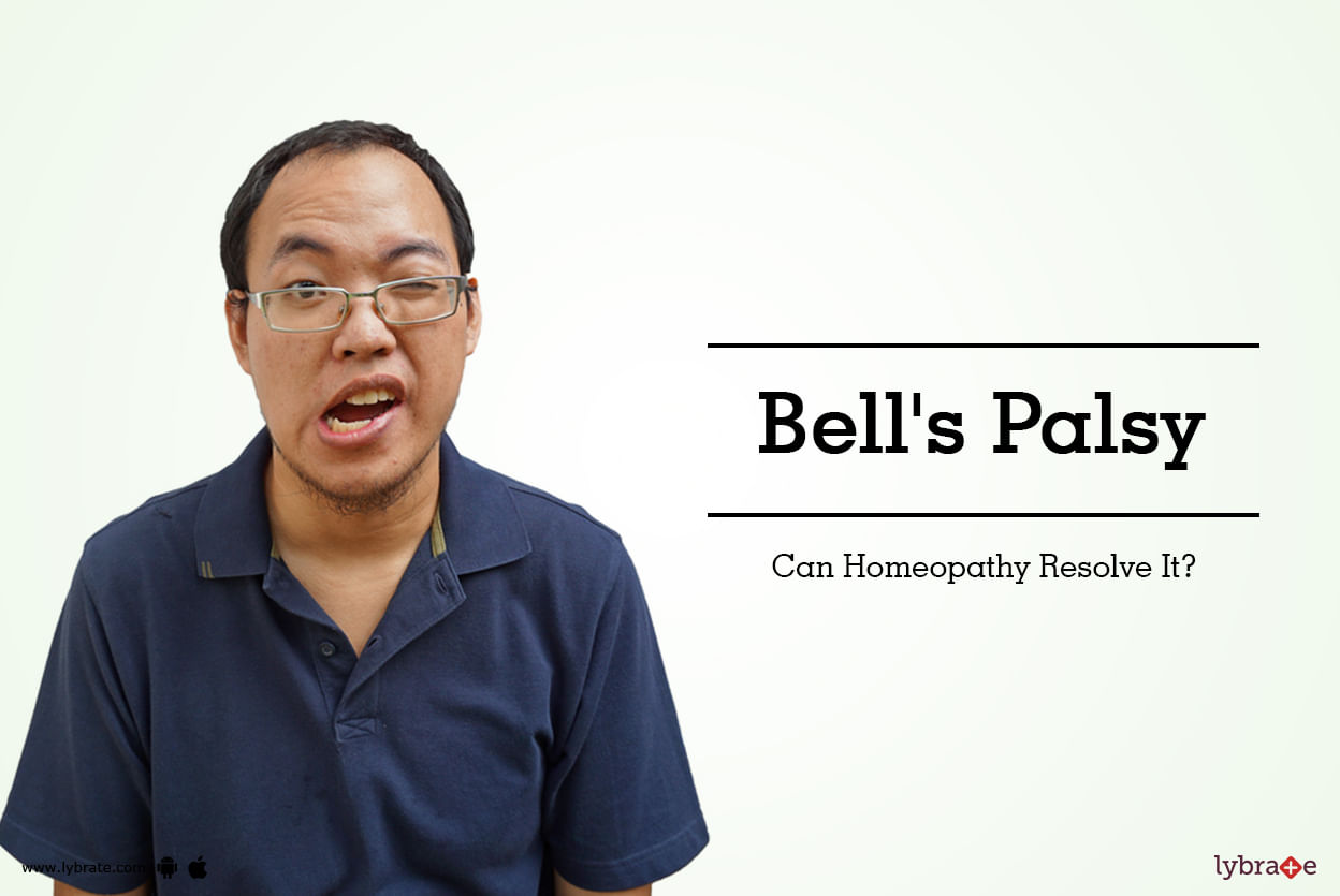 Bell's Palsy - Can Homeopathy Resolve It?