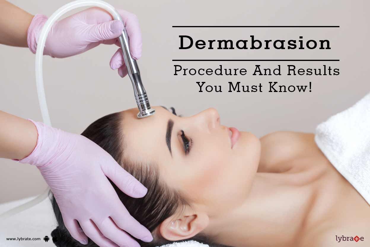 Dermabrasion - Procedure And Results You Must Know!