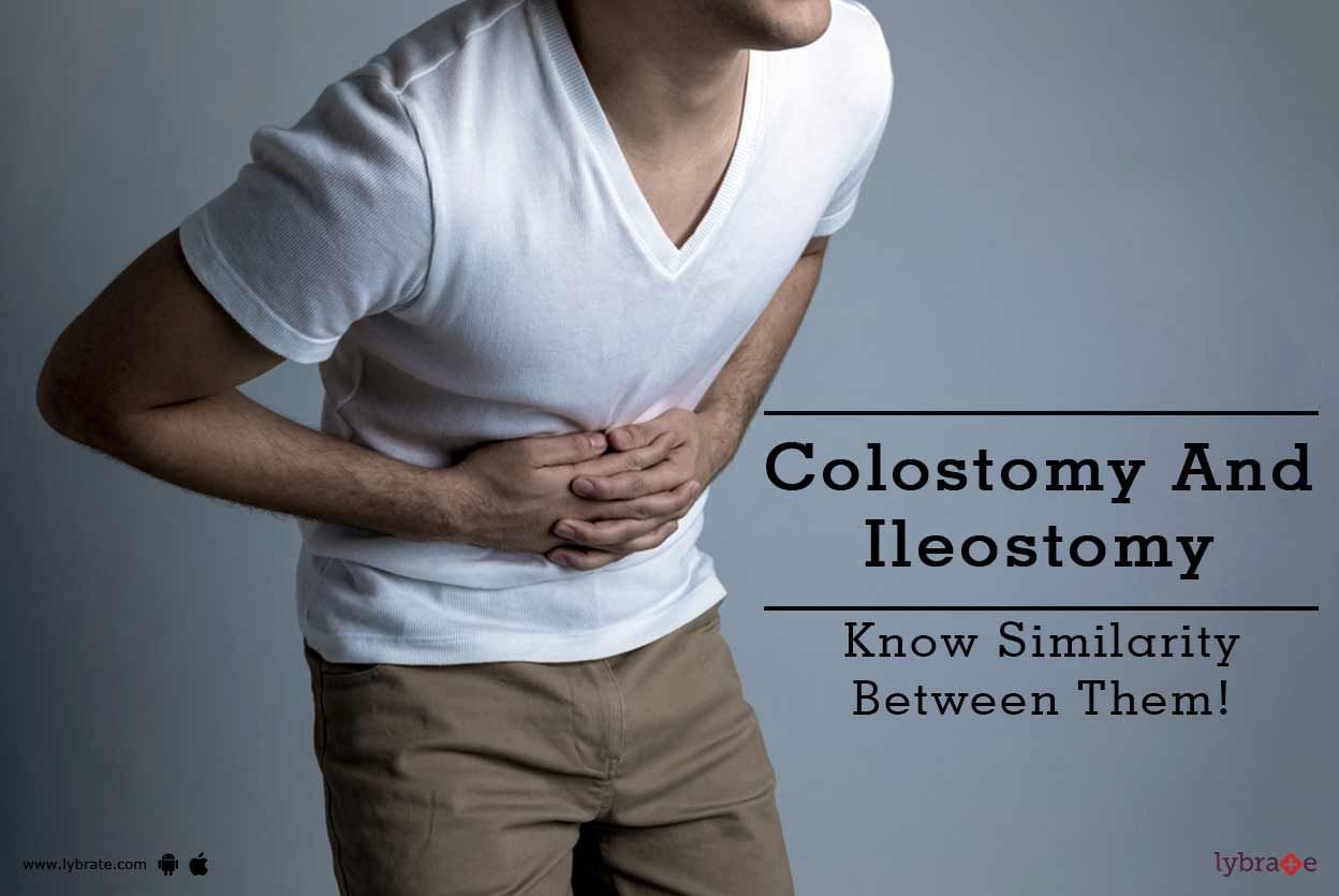 Colostomy And Ileostomy - Know Similarity Between Them!