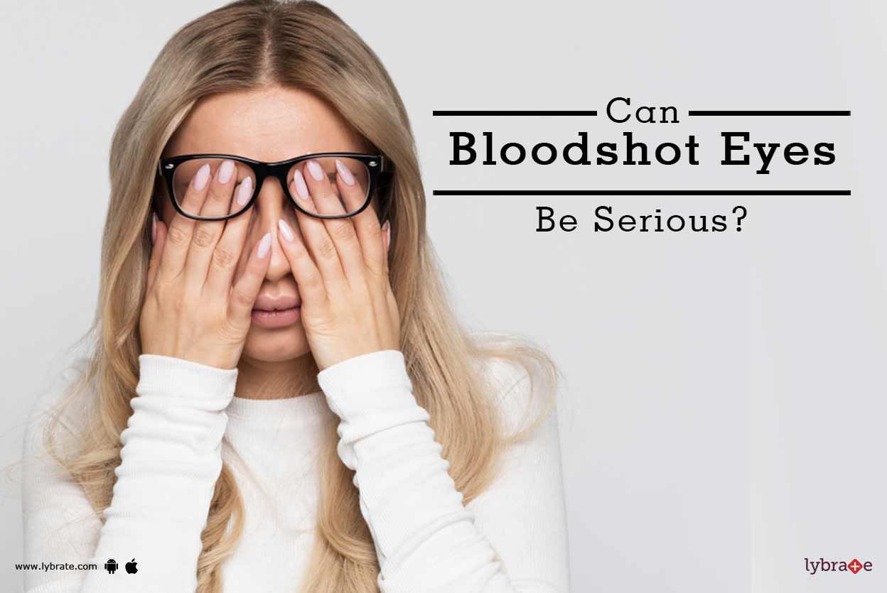 Can Bloodshot Eyes Be Serious?