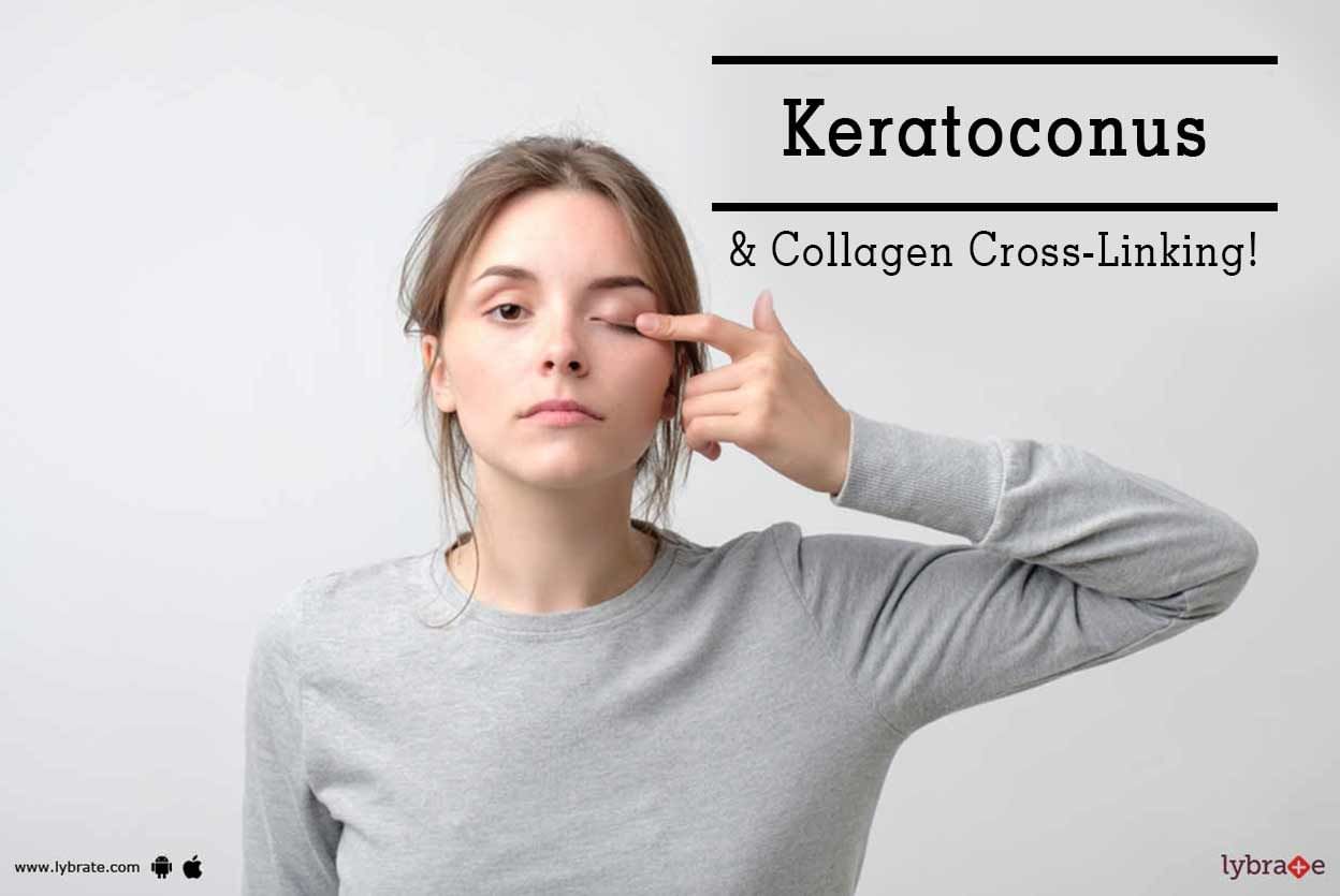 Keratoconus & Collagen Cross-Linking!