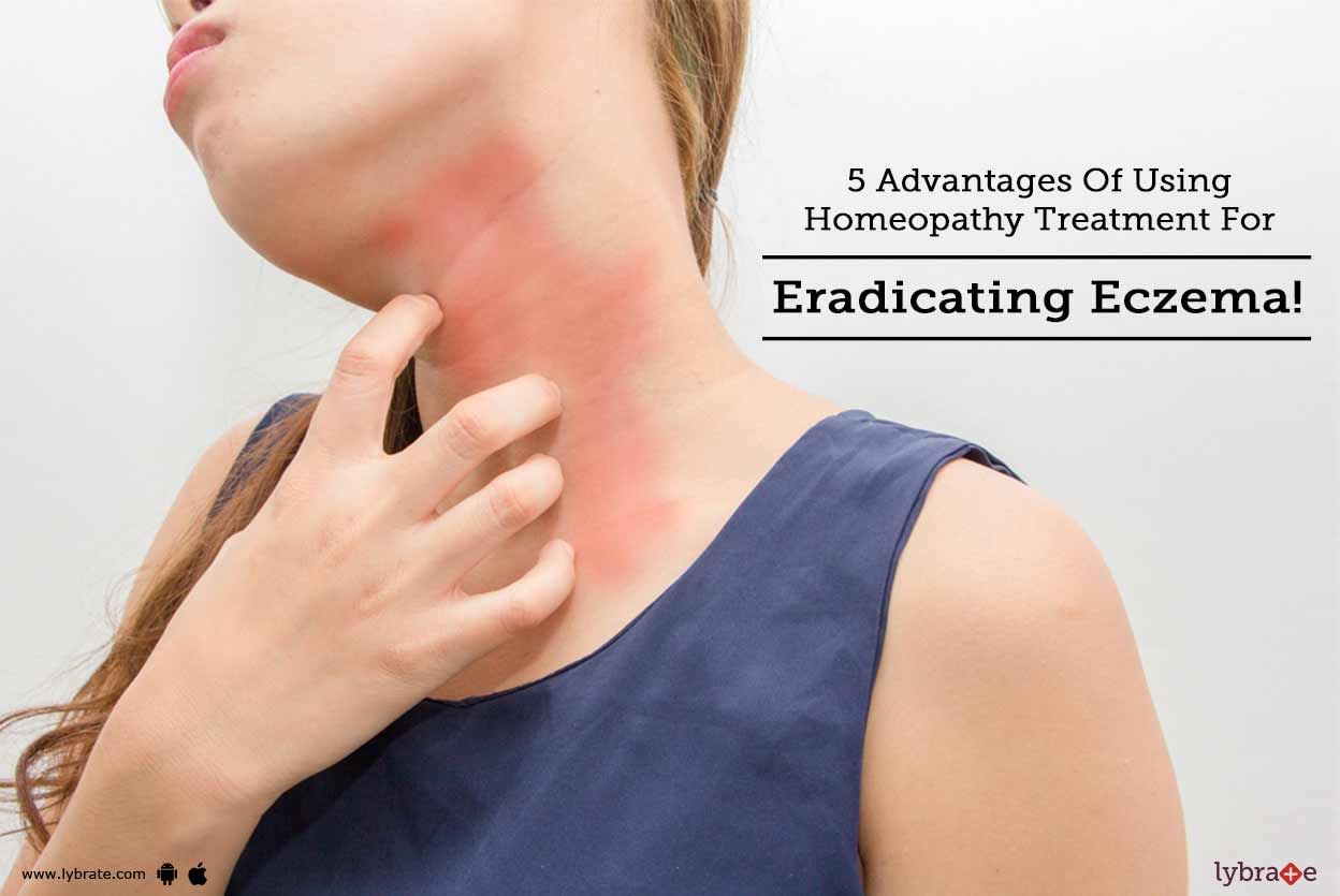 5 Advantages Of Using Homeopathy Treatment For Eradicating Eczema!