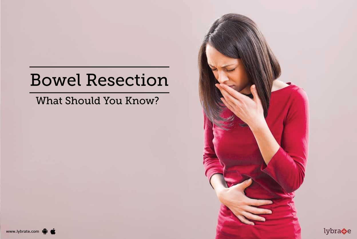 Bowel Resection - What Should You Know?