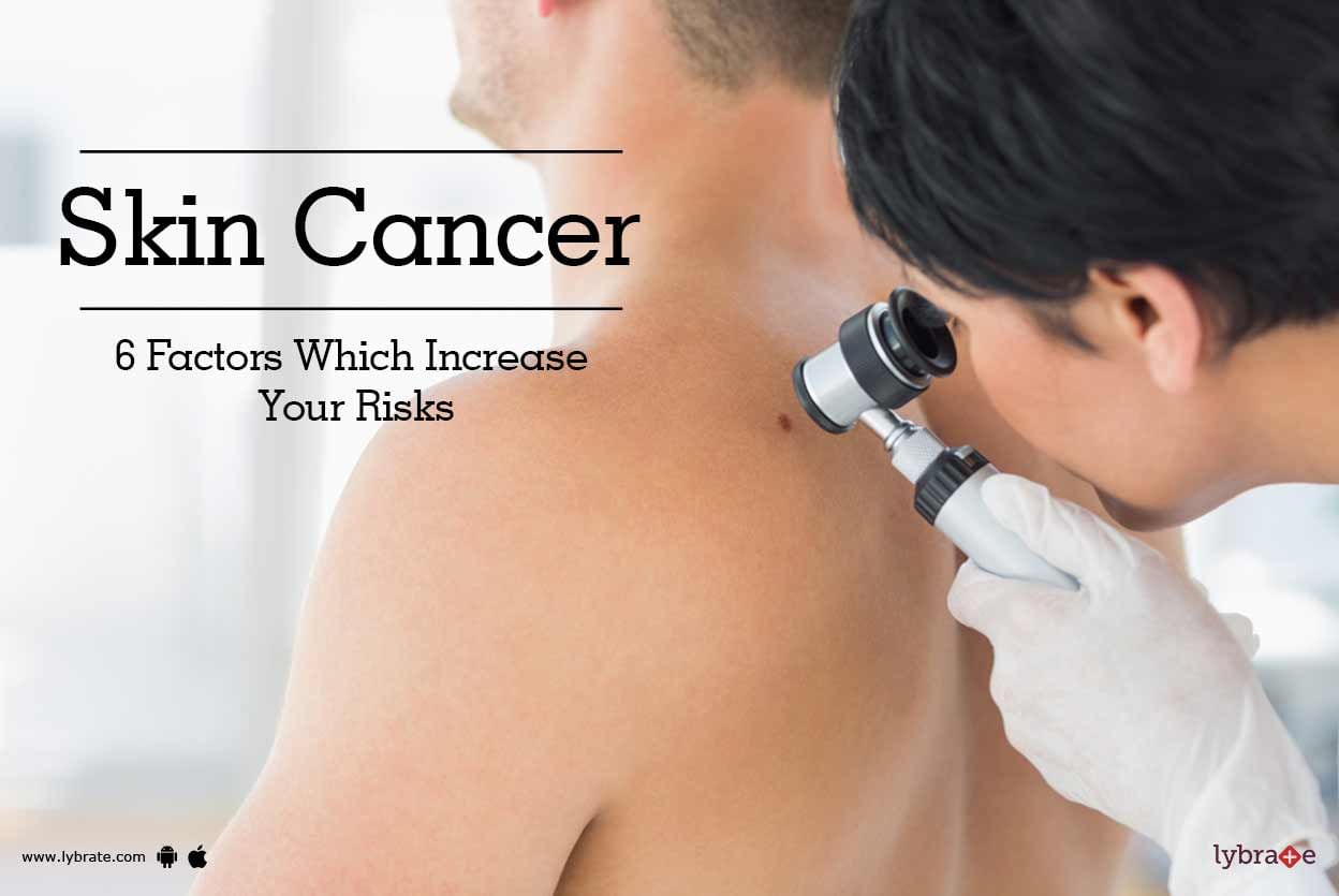 Skin Cancer - 6 Factors Which Increase Your Risks