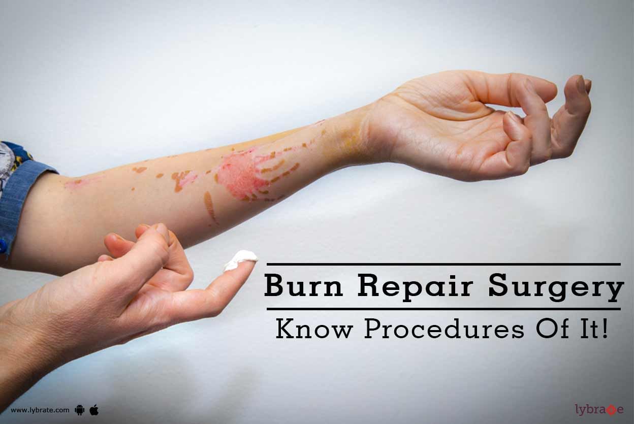 Burn Repair Surgery - Know Procedures Of It!
