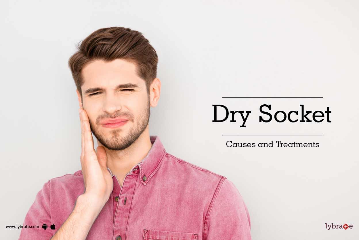 Dry Socket - Causes and Treatments