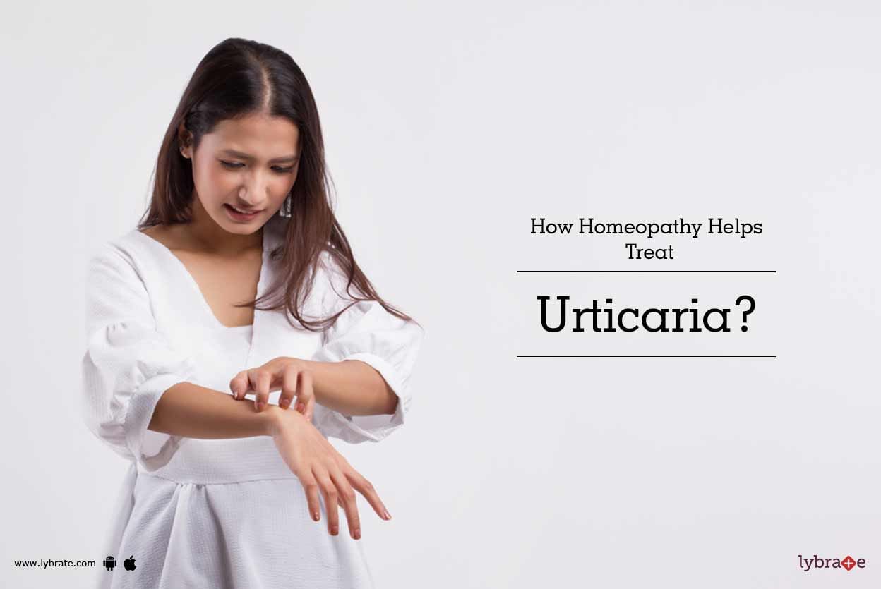 How Homeopathy Helps Treat Urticaria?