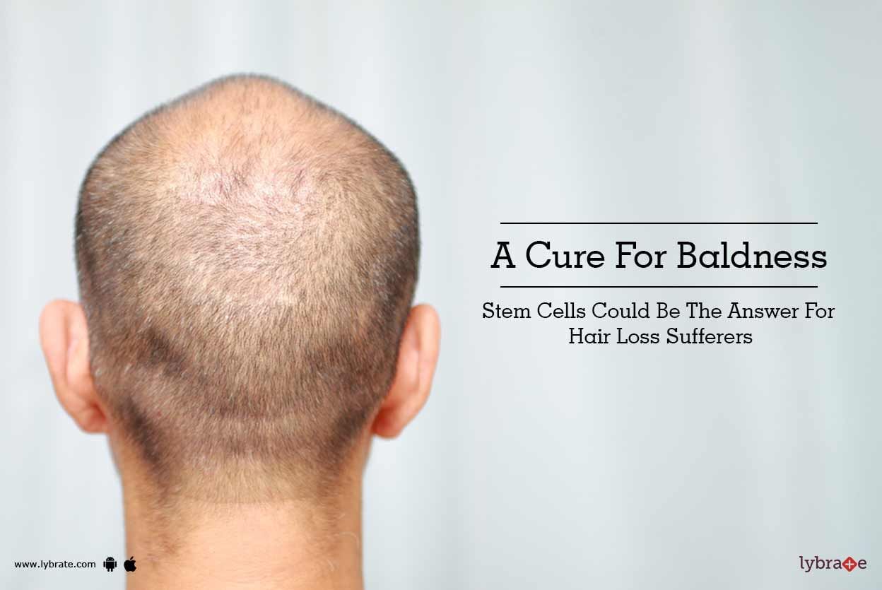 A Cure For Baldness - Stem Cells Could Be The Answer For Hair Loss Sufferers