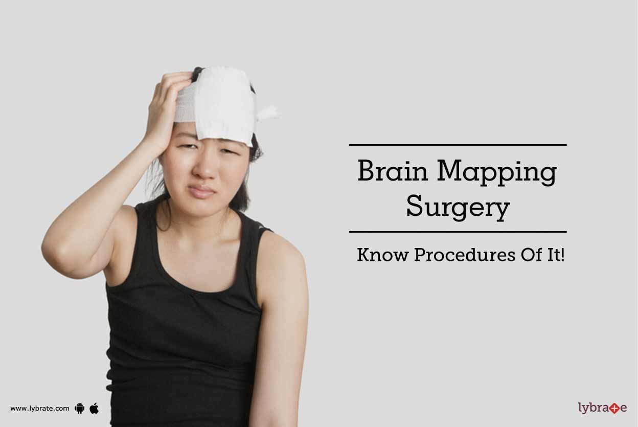 Brain Mapping Surgery - Know Procedures Of It!